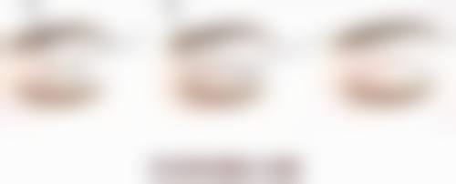 皮肤疤痕体质怎么治疗？激光+药物+压力疗法三管齐下，告别增生烦恼