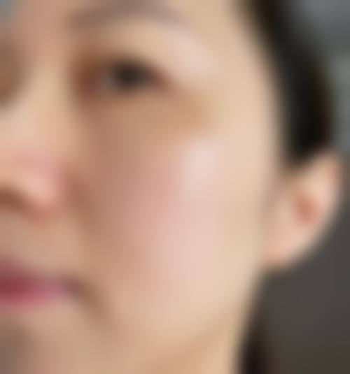 湖北省正规医美医院排名前十——武汉艺星医疗美容医院