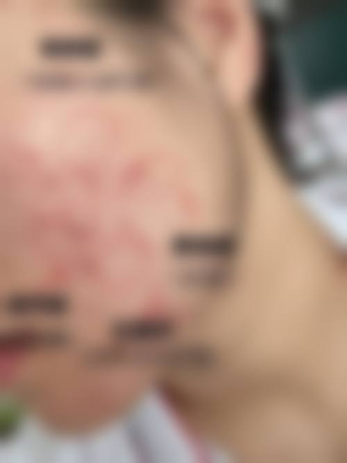 卢昱江医生简介口碑如何