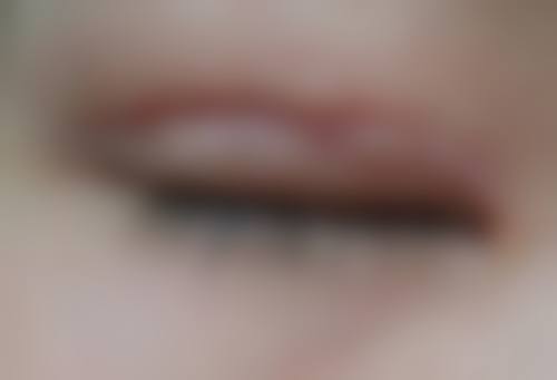 韩国VelyB医院怎么样项目特色