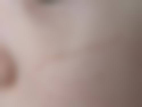 华世医生简介：做手术价格情况