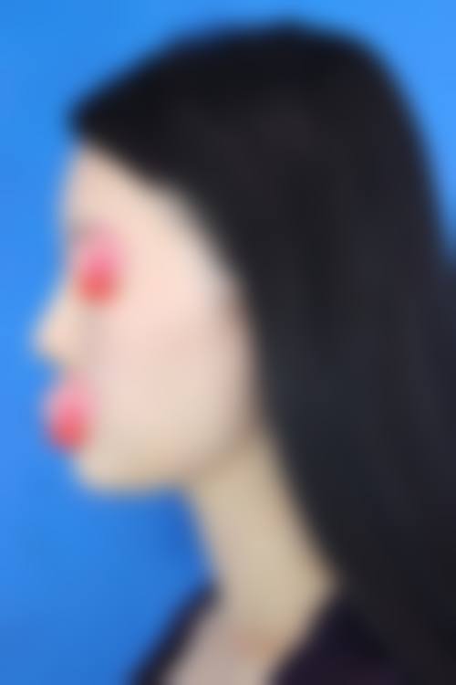 卢昱江医生简介做手术价格