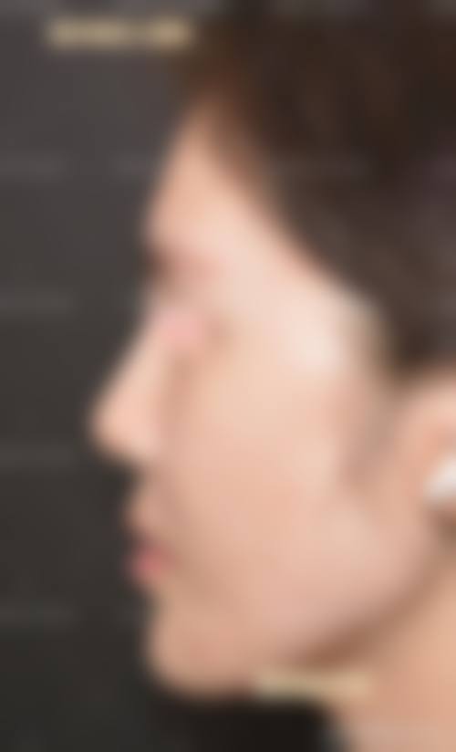 湖北省正规医美医院排名前十——十堰安琪儿医学美容门诊