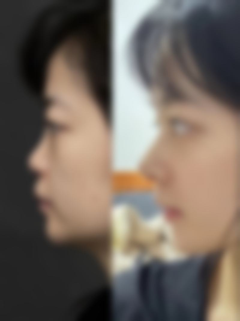 海口艾菲丝美容医院怎么样项目特色