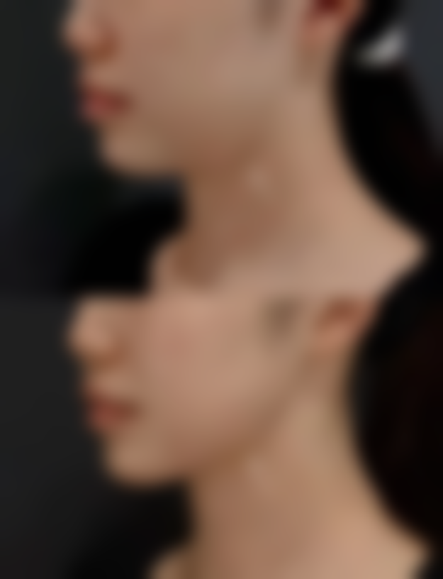 皮肤疤痕体质怎么治疗:心理调适——与疤痕和解的智慧