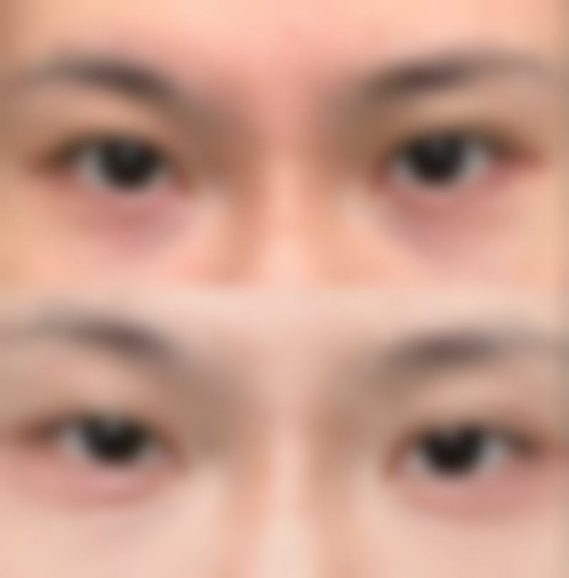 王吉耀医生项目优势