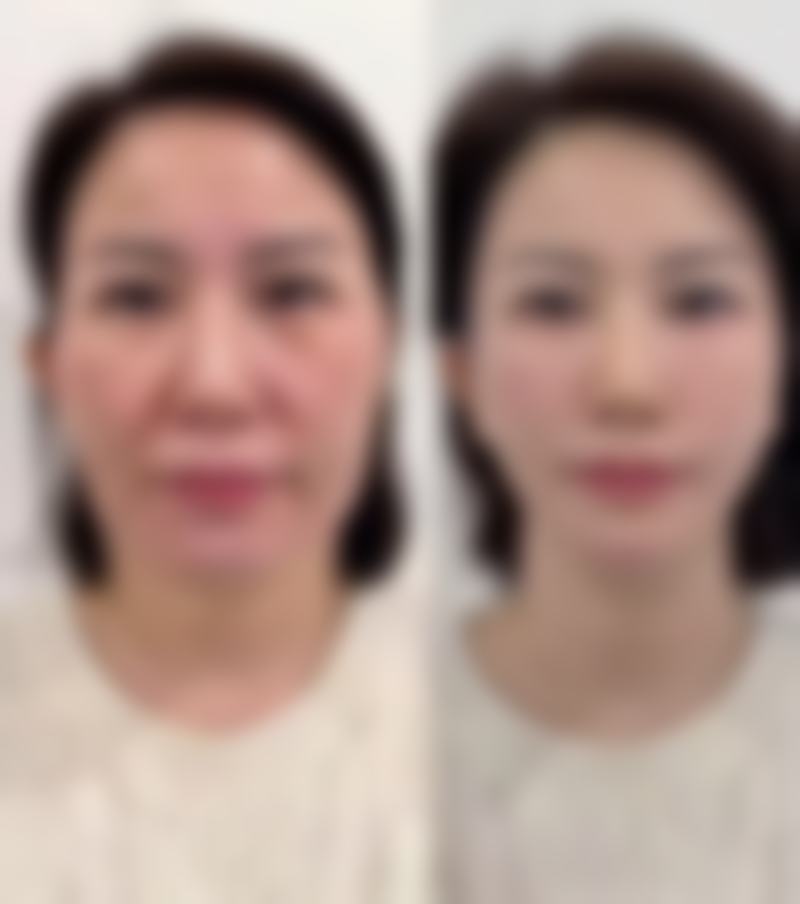 曾靖医生简介做手术价格