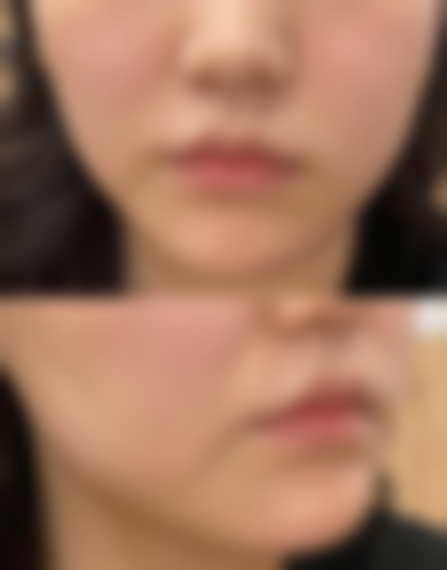 湖北省正规医美医院排名前十——武汉同济医院整形科