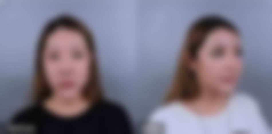 三、海南华美医学美容医院口碑评价如何？