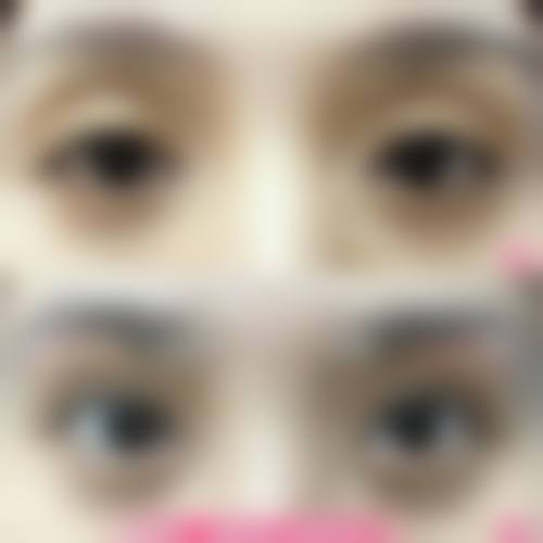 临沂兰山微美医疗美容门诊部价格表