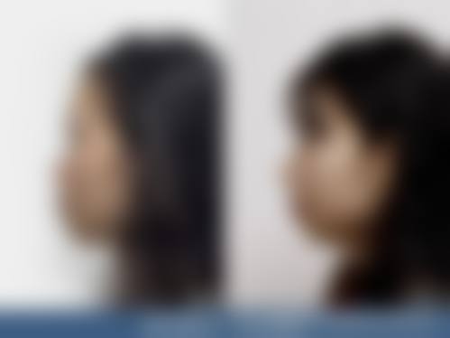 高培培医生怎么挂号