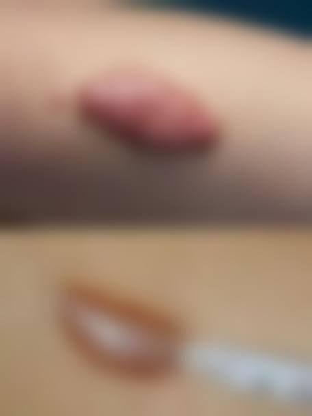 韩国Doctor Petit江南店皮肤科