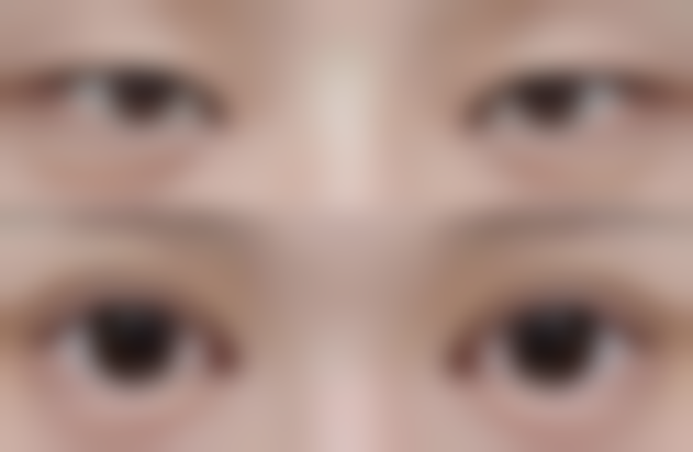 合法合规整形的重要性