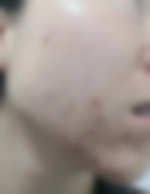 汕头艾妃媄后整形医院怎么样？地址及乘车路线