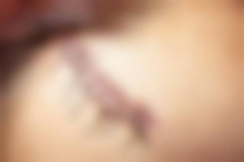 重庆医 科 大学附属儿童医院田晓菲医生简介做手术价格