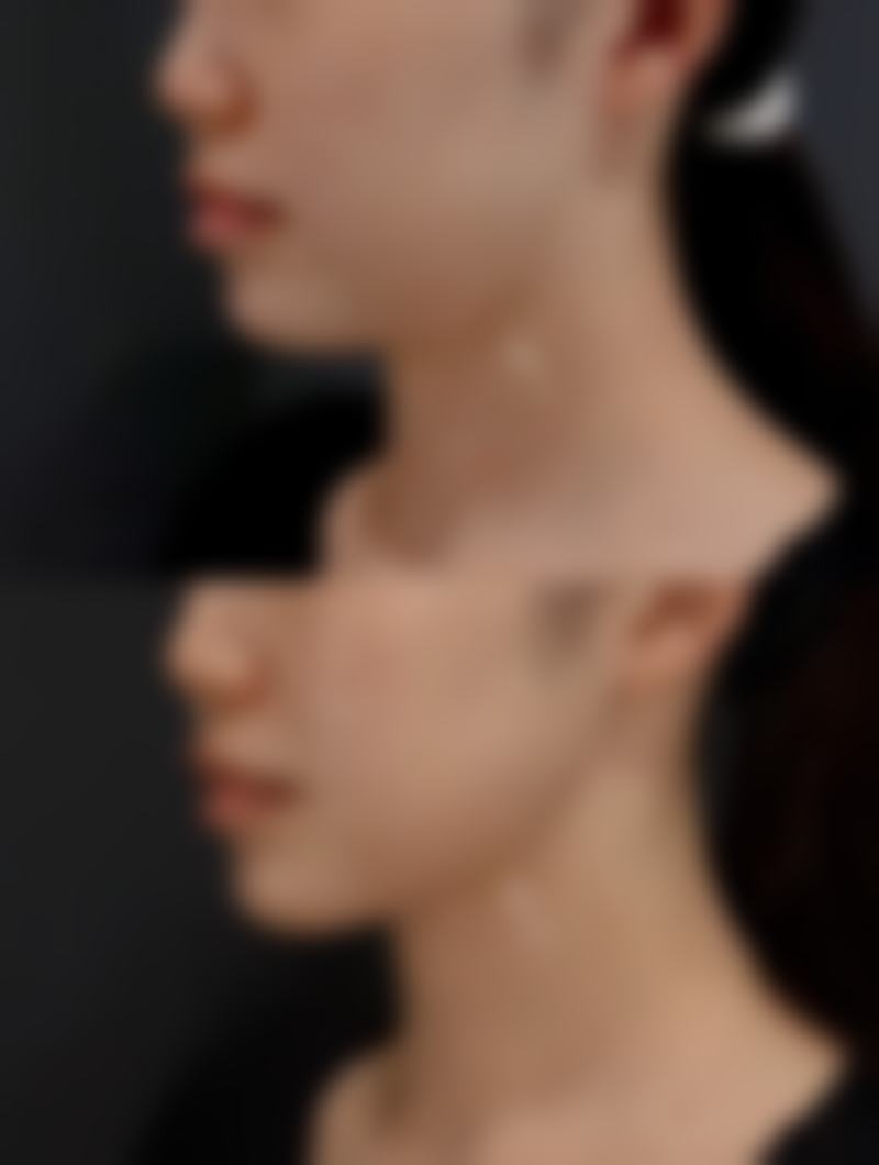 刘小娇医生项目优势