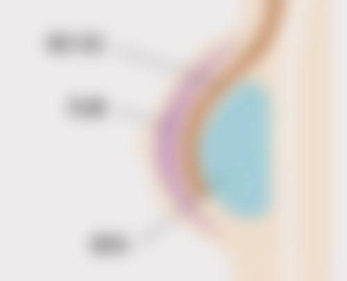 腹部吸脂后多久做射频紧肤：北京大学人民医院的建议