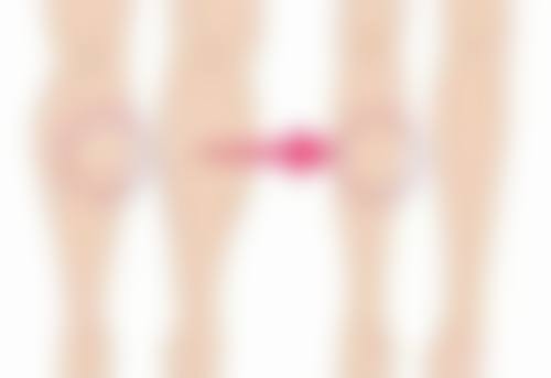 韩国Ever（艾源）整形外科抖音团购活动及价格表