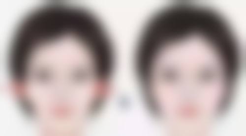 瘦脸针可以瘦屁股吗