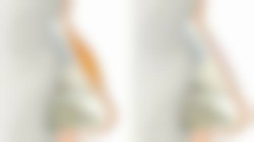 韩国Ever（艾源）整形外科口碑好不好