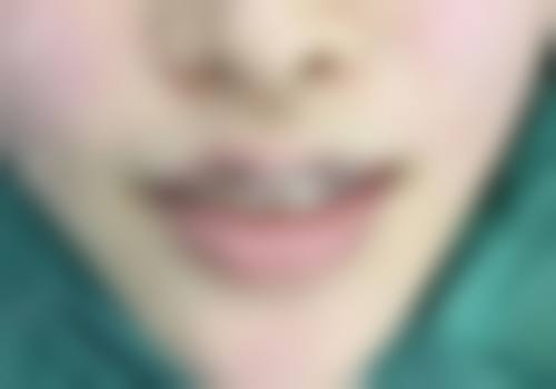 合肥真年轻美伦医疗美容诊所评价