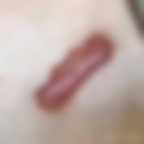 许昌正美韶华医疗整形郝文玉抗衰成效的显著反馈