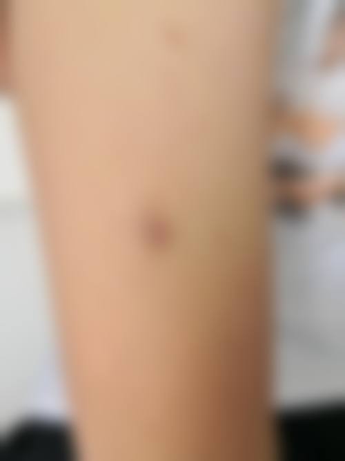 张秀杰医生简介口碑如何