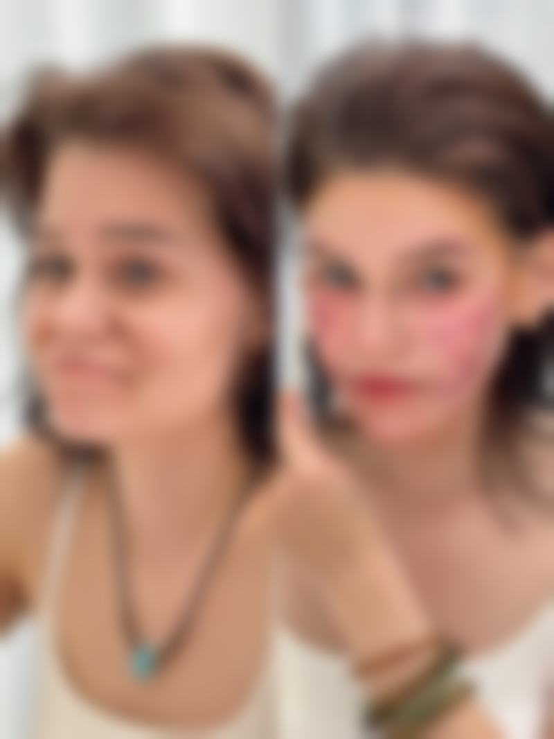 儿童缝针后的疤痕会留下怎么办之何时就医把握时机