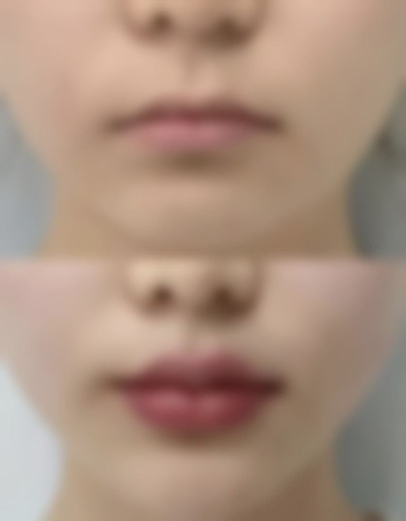 科学臀部塑形替代方案