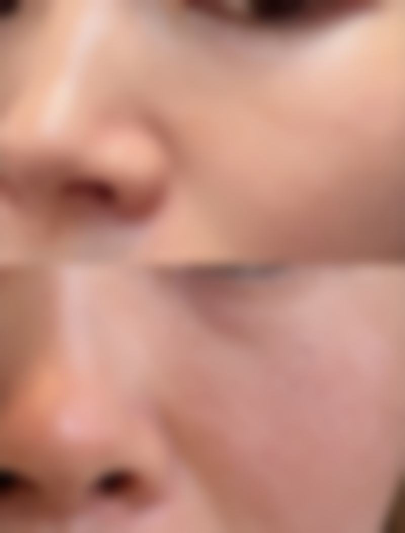 瘦脸针瘦屁股的价格猜想