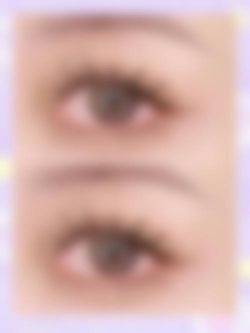 浙江杭州新生植发的口碑情况