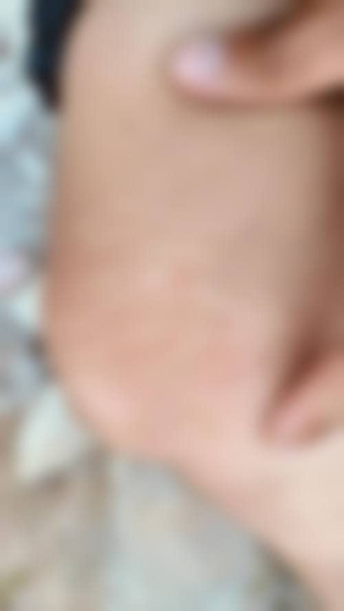 Pichet Rodchareon医生简介做手术价格