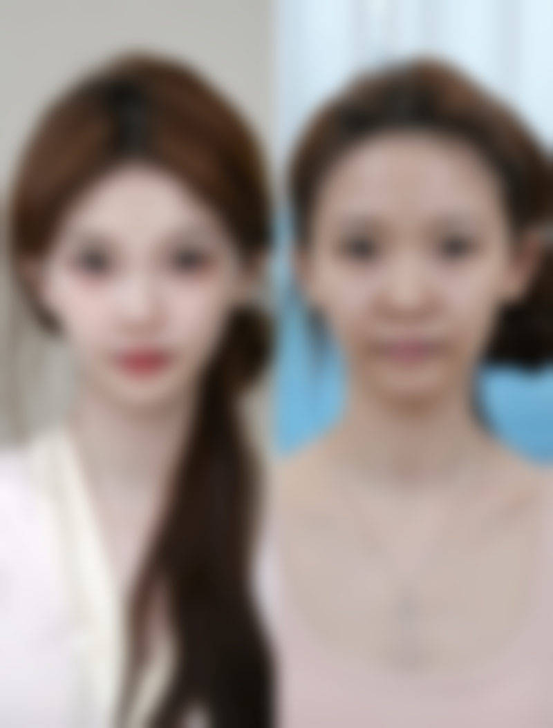 如何加速疤痕变软变平的过程