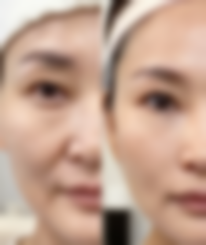 池德君医生项目优势