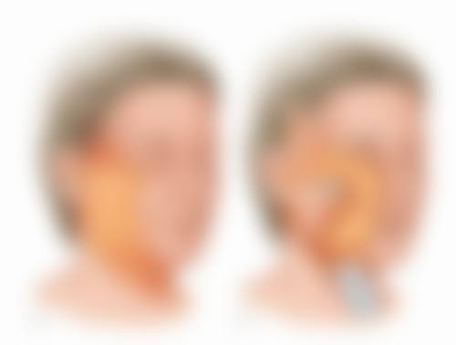 疤痕增生能用艾灸吗？上海宏康医院骨干医生多视角论证