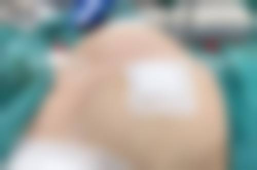 金宗炫医生做手术价格