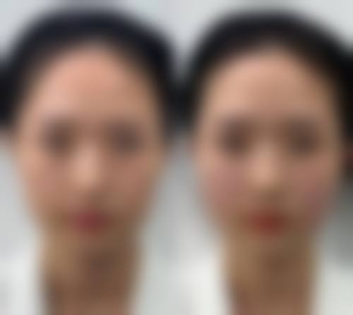 惠城瑞芙臣美容医院口碑好不好