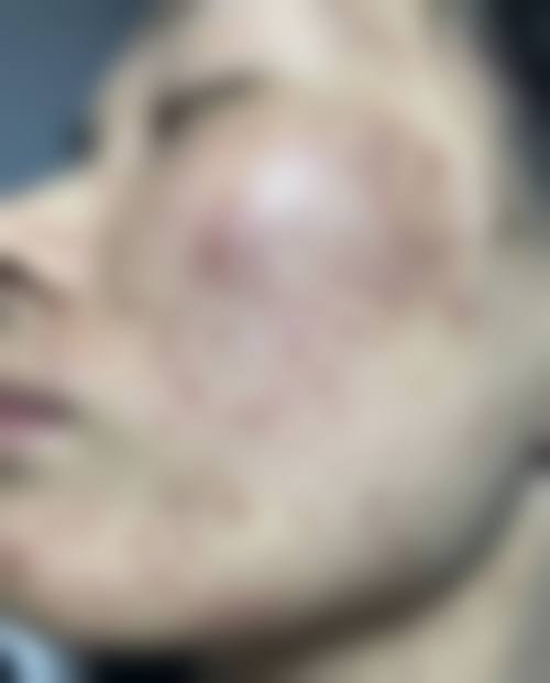 乌鲁木齐昕容妍整形怎么样抖音团购活动有哪些，价格表