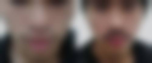 泸州发博士植发正规吗