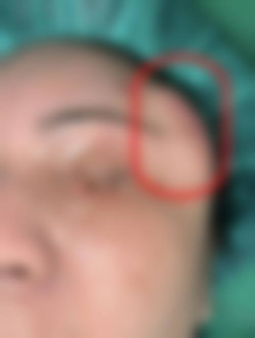 许扬滨医生简介做手术价格