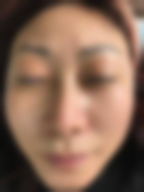 邱胜达医生简介做手术价格