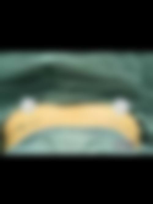 长沙美宸整形医院怎么样，口碑评价如何？