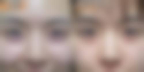 段建春医生简介项目优势