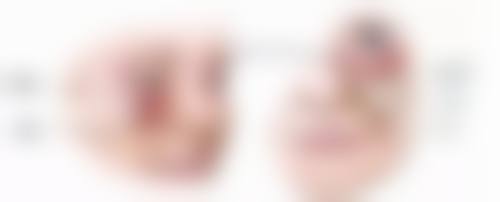 脸部抓伤疤痕怎么淡化——祛疤膏推荐：居家护理的贴心“守护者”