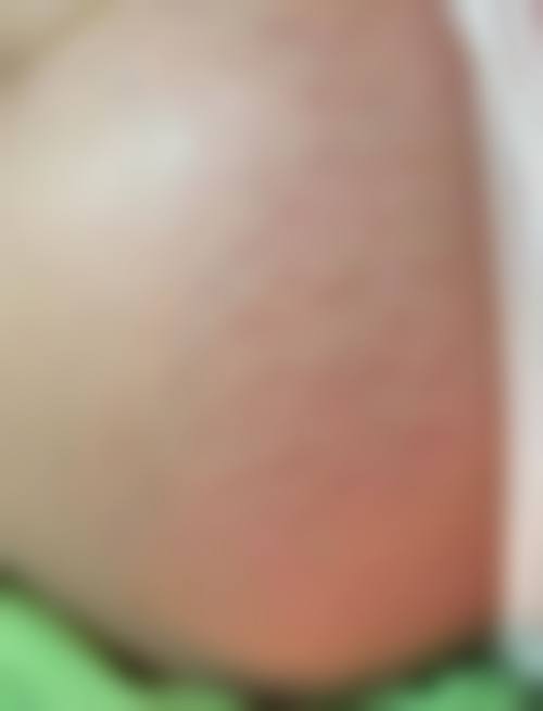 李东英医生顾客实例图片