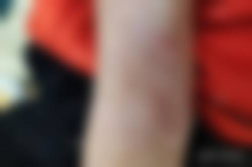 武汉柏荟医疗美容门诊部更擅长什么