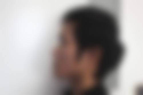 李东英医生做手术价格