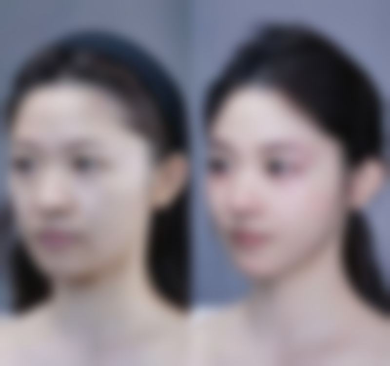 付芳芳医生简介做手术价格是多少