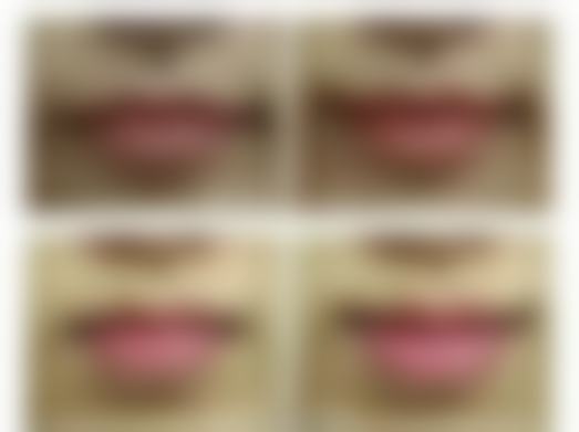 陈宝峰医生做手术价格