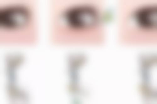 刘永飞医生做手术价格